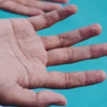 Pola kerutan pada jari yang disebabkan oleh perendaman dalam waktu yang lama akan tetap konsisten dari waktu ke waktu, demikian menurut sebuah studi baru.